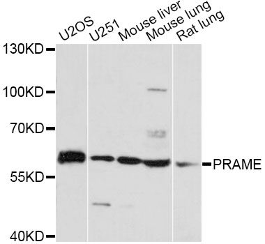 PRAME Antibody - Western blot analysis of extracts of various cell lines, using PRAME antibody at 1:3000 dilution. The secondary antibody used was an HRP Goat Anti-Rabbit IgG (H+L) at 1:10000 dilution. Lysates were loaded 25ug per lane and 3% nonfat dry milk in TBST was used for blocking. An ECL Kit was used for detection and the exposure time was 15s.