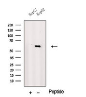 PRAME Antibody - Western blot analysis of extracts of HepG2 cells using PRAME antibody. The lane on the left was treated with blocking peptide.