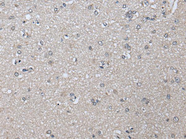 PRAME Antibody - Immunohistochemistry of paraffin-embedded Human brain tissue  using PRAME Polyclonal Antibody at dilution of 1:65(×200)