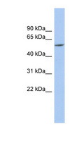 PRAME Antibody - PRAME antibody Western blot of Fetal Brain lysate. This image was taken for the unconjugated form of this product. Other forms have not been tested.