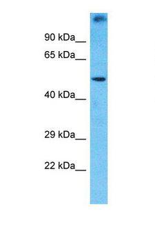 PRAMEF1 Antibody - Western blot of Human Jurkat. PRAMEF1 antibody dilution 1.0 ug/ml.  This image was taken for the unconjugated form of this product. Other forms have not been tested.