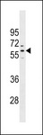 PRAMEF1 Antibody - PRAMEF1 Antibody western blot of NCI-H292 cell line lysates (35 ug/lane). The PRAMEF1 antibody detected the PRAMEF1 protein (arrow).
