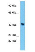 PRAMEF11 Antibody - PRAMEF11 antibody Western Blot of A549. Antibody dilution: 1 ug/ml.  This image was taken for the unconjugated form of this product. Other forms have not been tested.