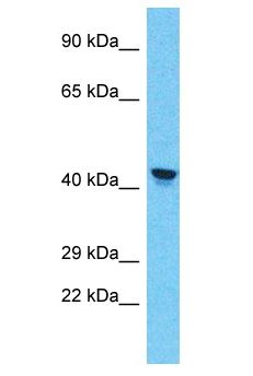 PRAMEF11 Antibody - PRAMEF11 antibody Western Blot of A549. Antibody dilution: 1 ug/ml.  This image was taken for the unconjugated form of this product. Other forms have not been tested.