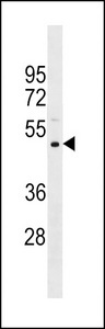 PRAMEF11 Antibody - PRAMEF11 Antibody western blot of Uterus tissue lysates (35 ug/lane). The PRAMEF11 antibody detected the PRAMEF11 protein (arrow).