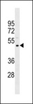 PRAMEF11 Antibody - PRAMEF11 Antibody western blot of Uterus tissue lysates (35 ug/lane). The PRAMEF11 antibody detected the PRAMEF11 protein (arrow).