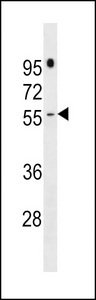 PRAMEF16 Antibody - PRAMEF16 Antibody western blot of NCI-H292 cell line lysates (35 ug/lane). The PRAMEF16 antibody detected the PRAMEF16 protein (arrow).