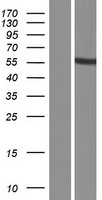 PRAMEF16 Protein - Western validation with an anti-DDK antibody * L: Control HEK293 lysate R: Over-expression lysate