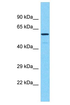 PRAMEF17 Antibody - PRAMEF17 antibody Western Blot of 721_B. Antibody dilution: 1 ug/ml.  This image was taken for the unconjugated form of this product. Other forms have not been tested.