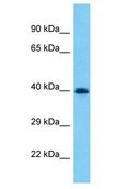 PRAMEF19 Antibody - PRAMEF19 antibody Western Blot of 721_B. Antibody dilution: 1 ug/ml.  This image was taken for the unconjugated form of this product. Other forms have not been tested.