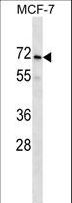 PRAMEF2 Antibody - PRAMEF2 Antibody western blot of MCF-7 cell line lysates (35 ug/lane). The PRAMEF2 antibody detected the PRAMEF2 protein (arrow).