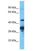 PRAMEF2 Antibody - PRAMEF2 antibody Western Blot of OVCAR-3. Antibody dilution: 1 ug/ml.  This image was taken for the unconjugated form of this product. Other forms have not been tested.