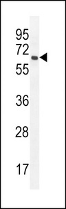 PRAMEF20 Antibody - PRAMEF20 Antibody western blot of MDA-MB435 cell line lysates (35 ug/lane). The PRAMEF20 antibody detected the PRAMEF20 protein (arrow).