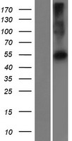 PRAMEF22 Protein - Western validation with an anti-DDK antibody * L: Control HEK293 lysate R: Over-expression lysate