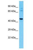 PRAMEF7 Antibody - PRAMEF7 antibody Western Blot of A549. Antibody dilution: 1 ug/ml.  This image was taken for the unconjugated form of this product. Other forms have not been tested.