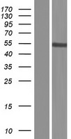 PRAMEF8 Protein - Western validation with an anti-DDK antibody * L: Control HEK293 lysate R: Over-expression lysate