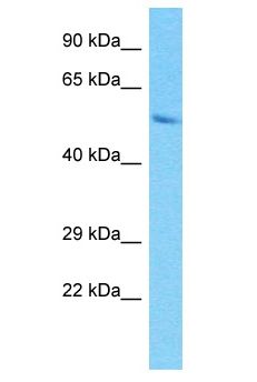 PRAMEF9 Antibody - PRAMEF9 antibody Western Blot of HepG2. Antibody dilution: 1 ug/ml.  This image was taken for the unconjugated form of this product. Other forms have not been tested.