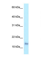 PRAP1 Antibody - PRAP1 antibody Western blot of 1 Cell lysate. Antibody concentration 1 ug/ml.  This image was taken for the unconjugated form of this product. Other forms have not been tested.