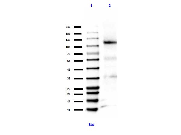 PRB1 Antibody - Western Blot of rabbit anti-Retinoblastoma [Monomethyl Lys860] antibody. Lane 1: MW ladder (opal pre-stained). Lane 2: MOLT-4 WCL. Load: 35 ug per lane. Primary antibody: Retinoblastoma antibody at 1:1000 for overnight at 4°C. Secondary antibody: rabbit secondary HRP antibody at 1:70,000 for 30 min at RT. Block: BlockOut 30 min at RT. Predicted/Observed size: expect 106 kDa for Retinoblastoma protein.