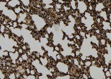 PRC1 Antibody - 1:100 staining mouse lung tissue by IHC-P. The sample was formaldehyde fixed and a heat mediated antigen retrieval step in citrate buffer was performed. The sample was then blocked and incubated with the antibody for 1.5 hours at 22°C. An HRP conjugated goat anti-rabbit antibody was used as the secondary.