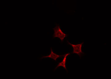 PRC1 Antibody - Staining HepG2 cells by IF/ICC. The samples were fixed with PFA and permeabilized in 0.1% Triton X-100, then blocked in 10% serum for 45 min at 25°C. The primary antibody was diluted at 1:200 and incubated with the sample for 1 hour at 37°C. An Alexa Fluor 594 conjugated goat anti-rabbit IgG (H+L) Ab, diluted at 1/600, was used as the secondary antibody.