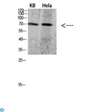 PRC1 Antibody - Western blot analysis of KB and HeLa lysate, antibody was diluted at 500. Secondary antibody was diluted at 1:20000.