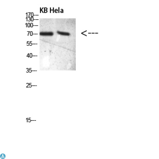PRC1 Antibody - Western blot analysis of KB and Hela, antibody was diluted at 500. Secondary antibody was diluted at 1:20000.
