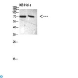 PRC1 Antibody - Western blot analysis of KB and Hela, antibody was diluted at 500. Secondary antibody was diluted at 1:20000.