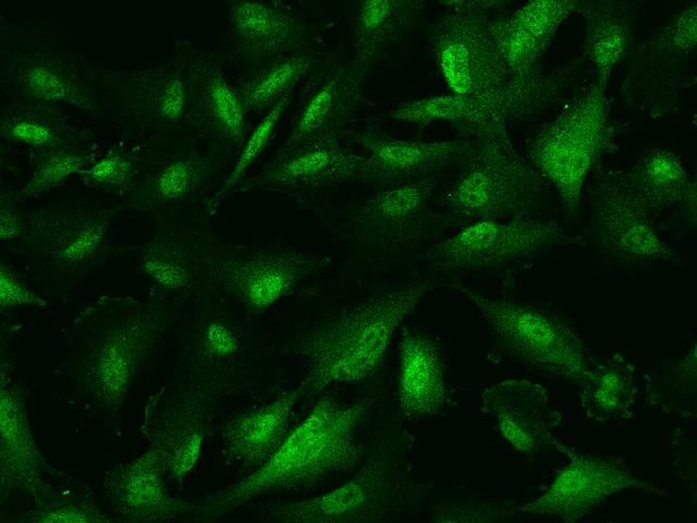 PRC1 Antibody - Immunofluorescence staining of PRC1 in U251MG cells. Cells were fixed with 4% PFA, permeabilzed with 0.1% Triton X-100 in PBS, blocked with 10% serum, and incubated with rabbit anti-Human PRC1 polyclonal antibody (dilution ratio 1:200) at 4°C overnight. Then cells were stained with the Alexa Fluor 488-conjugated Goat Anti-rabbit IgG secondary antibody (green). Positive staining was localized to Nucleus and Cytoplasm and cell membrane.