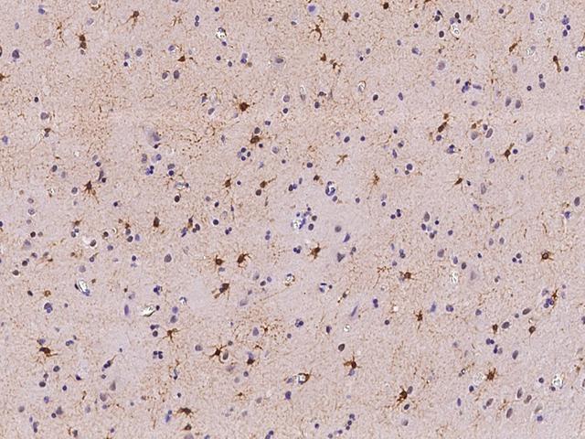 PRC1 Antibody - Immunochemical staining of human PRC1 in human brain with rabbit polyclonal antibody at 1:200 dilution, formalin-fixed paraffin embedded sections.