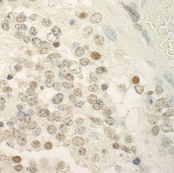 PRCC / RCCP1 Antibody - Detection of Mouse PRCC by Immunohistochemistry. Sample: FFPE section of mouse teratoma. Antibody: Affinity purified rabbit anti-PRCC used at a dilution of 1:250.