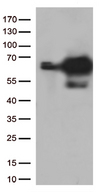 PRCC / RCCP1 Antibody - HEK293T cells were transfected with the pCMV6-ENTRY control. (Left lane) or pCMV6-ENTRY PRCC. (Right lane) cDNA for 48 hrs and lysed
