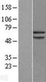 PRCC / RCCP1 Protein - Western validation with an anti-DDK antibody * L: Control HEK293 lysate R: Over-expression lysate
