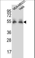 PRCP Antibody - PRCP Antibody western blot of MDA-MB231,HeLa cell line lysates (35 ug/lane). The PRCP antibody detected the PRCP protein (arrow).