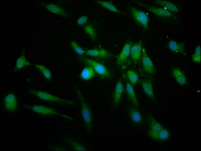 PRCP Antibody - Immunofluorescence staining of Hela cells at a dilution of 1:166, counter-stained with DAPI. The cells were fixed in 4% formaldehyde, permeabilized using 0.2% Triton X-100 and blocked in 10% normal Goat Serum. The cells were then incubated with the antibody overnight at 4 °C.The secondary antibody was Alexa Fluor 488-congugated AffiniPure Goat Anti-Rabbit IgG (H+L) .