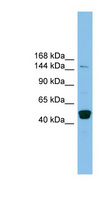 PRDM10 / TRIS Antibody - PRDM10 antibody Western blot of THP-1 cell lysate. This image was taken for the unconjugated form of this product. Other forms have not been tested.