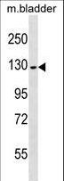 PRDM10 / TRIS Antibody - PRDM10 Antibody western blot of mouse bladder tissue lysates (35 ug/lane). The PRDM10 antibody detected the PRDM10 protein (arrow).