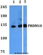 PRDM10 / TRIS Antibody - Western blot of PRDM10 antibody at 1:500 dilution. Lane 1: A549 whole cell lysate. Lane 2: sp2/0 whole cell lysate. Lane 3: H9C2 whole cell lysate.