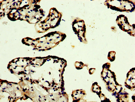 PRDM10 / TRIS Antibody - Immunohistochemistry image at a dilution of 1:300 and staining in paraffin-embedded human placenta tissue performed on a Leica BondTM system. After dewaxing and hydration, antigen retrieval was mediated by high pressure in a citrate buffer (pH 6.0) . Section was blocked with 10% normal goat serum 30min at RT. Then primary antibody (1% BSA) was incubated at 4 °C overnight. The primary is detected by a biotinylated secondary antibody and visualized using an HRP conjugated SP system.