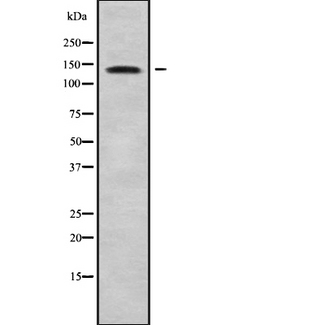 PRDM10 / TRIS Antibody - Western blot analysis of PRDM10 using K562 whole cells lysates