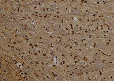 PRDM10 / TRIS Antibody - 1:100 staining rat brain tissue by IHC-P. The sample was formaldehyde fixed and a heat mediated antigen retrieval step in citrate buffer was performed. The sample was then blocked and incubated with the antibody for 1.5 hours at 22°C. An HRP conjugated goat anti-rabbit antibody was used as the secondary.