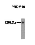PRDM10 / TRIS Antibody - Western of extracts from 293 cells using PRDM10 antibody.