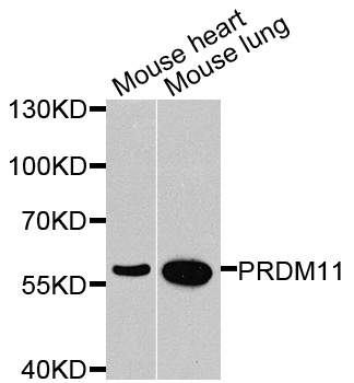 PRDM11 Antibody - Western blot analysis of extracts of various cells.
