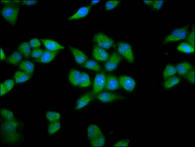 PRDM11 Antibody - Immunofluorescence staining of Hela cells diluted at 1:200, counter-stained with DAPI. The cells were fixed in 4% formaldehyde, permeabilized using 0.2% Triton X-100 and blocked in 10% normal Goat Serum. The cells were then incubated with the antibody overnight at 4°C.The Secondary antibody was Alexa Fluor 488-congugated AffiniPure Goat Anti-Rabbit IgG (H+L).