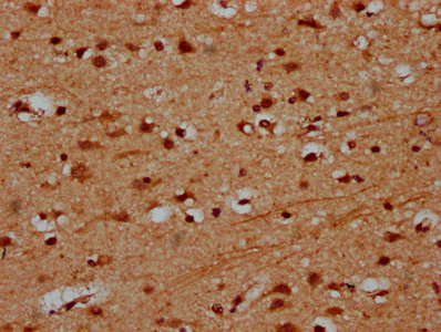 PRDM11 Antibody - Immunohistochemistry Dilution at 1:600 and staining in paraffin-embedded human brain tissue performed on a Leica BondTM system. After dewaxing and hydration, antigen retrieval was mediated by high pressure in a citrate buffer (pH 6.0). Section was blocked with 10% normal Goat serum 30min at RT. Then primary antibody (1% BSA) was incubated at 4°C overnight. The primary is detected by a biotinylated Secondary antibody and visualized using an HRP conjugated SP system.