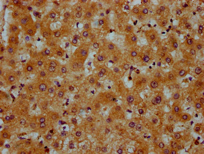 PRDM11 Antibody - Immunohistochemistry Dilution at 1:600 and staining in paraffin-embedded human liver tissue performed on a Leica BondTM system. After dewaxing and hydration, antigen retrieval was mediated by high pressure in a citrate buffer (pH 6.0). Section was blocked with 10% normal Goat serum 30min at RT. Then primary antibody (1% BSA) was incubated at 4°C overnight. The primary is detected by a biotinylated Secondary antibody and visualized using an HRP conjugated SP system.