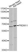 PRDM11 Antibody - Western blot analysis of extracts of various cell lines, using PRDM11 antibody at 1:1000 dilution. The secondary antibody used was an HRP Goat Anti-Rabbit IgG (H+L) at 1:10000 dilution. Lysates were loaded 25ug per lane and 3% nonfat dry milk in TBST was used for blocking. An ECL Kit was used for detection and the exposure time was 90s.