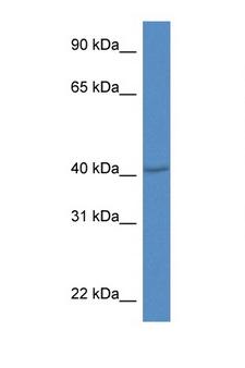 PRDM12 Antibody - PRDM12 antibody Western blot of Mouse Thymus lysate. Antibody concentration 1 ug/ml.  This image was taken for the unconjugated form of this product. Other forms have not been tested.