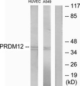 PRDM12 Antibody - Western blot analysis of lysates from HUVEC and A549 cells, using PRDM12 Antibody. The lane on the right is blocked with the synthesized peptide.