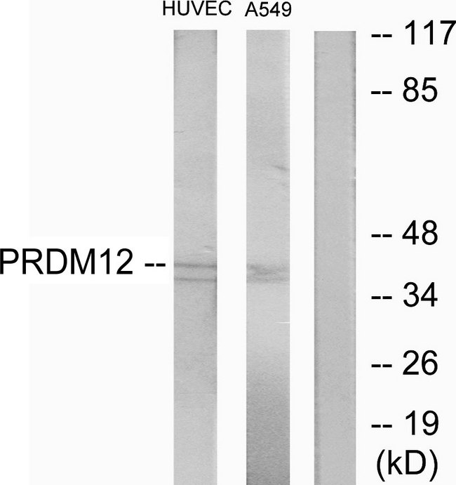 PRDM12 Antibody - Western blot analysis of lysates from HUVEC and A549 cells, using PRDM12 Antibody. The lane on the right is blocked with the synthesized peptide.